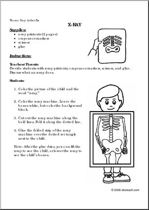 Activity Letter X: X-Ray